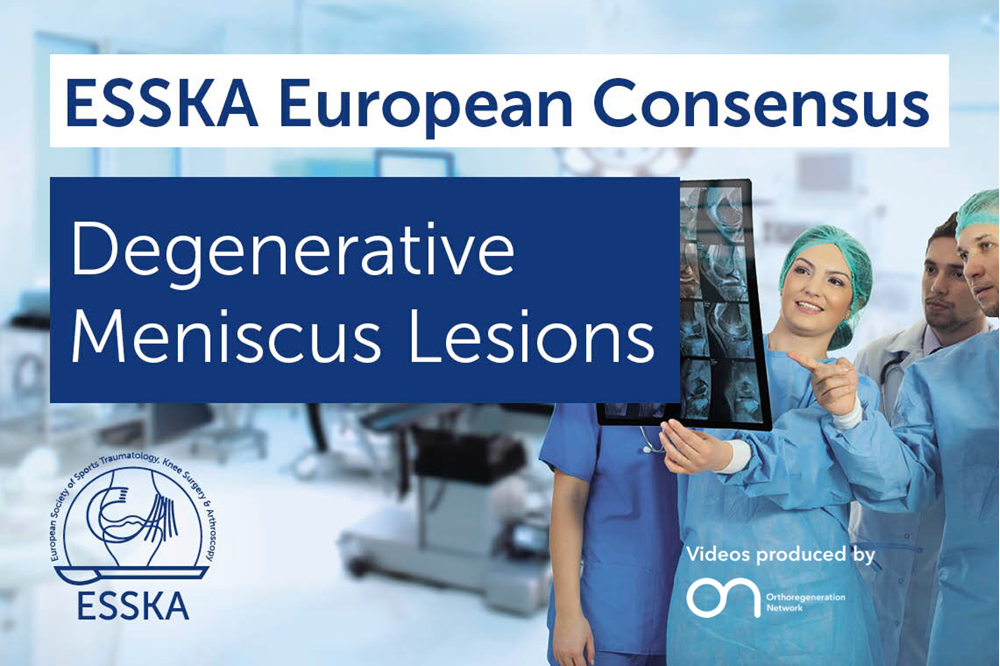 ESSKA Consensus videos image_Meniscus_myONFocus_0.PNG